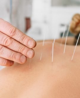 Bem estar e equilibrio Acumpuntaura e Medicina Integrativa na CLIMEP MED